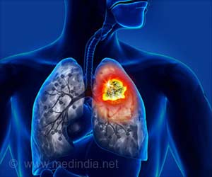 抗过敏药物Dupilumab治疗肺癌